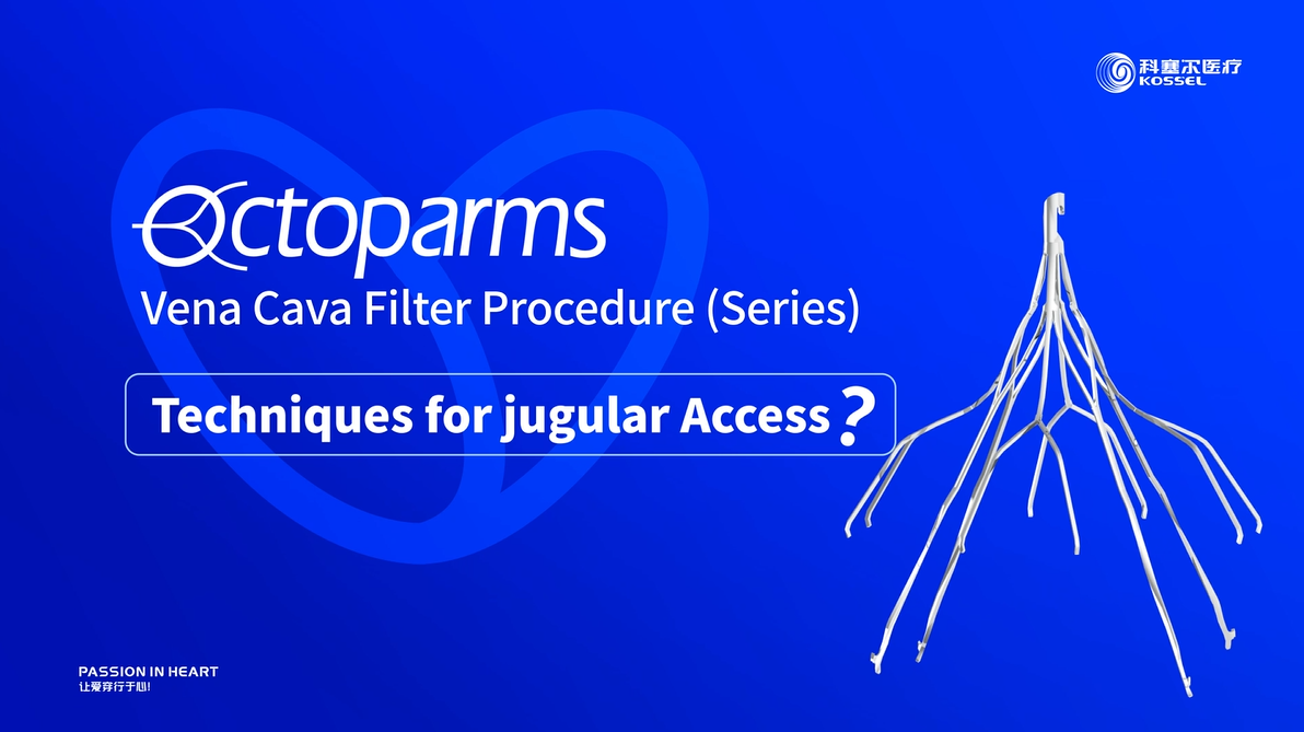 Vena Cava Filter Procedure (Series)